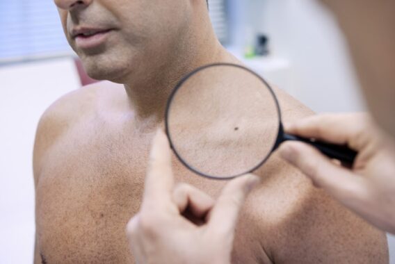 How Often Should You Be Seen for Skin Cancer Prevention?