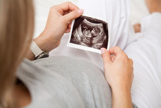 Acne and Pregnancy: How to Treat It Safely