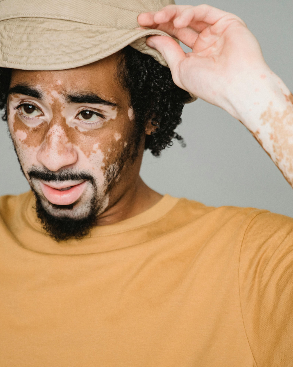 March is National Autoimmune Disease Awareness Month