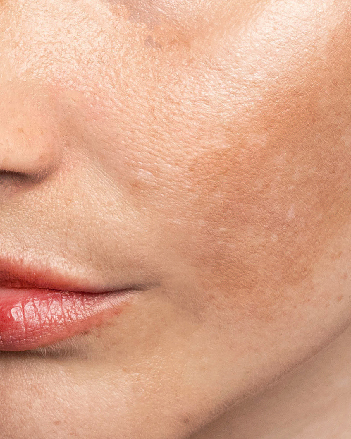 Melasma vs. Sun Spots vs. Age Spots: How to Tell Them Apart